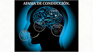 Maybe you would like to learn more about one of these? Afasia De Conduccion By Angie Suarez