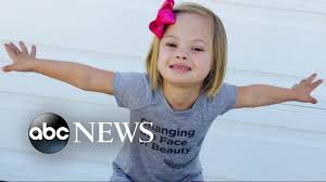 Girl Tells The World That Down Syndrome Is Not Scary Youtube