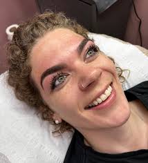 Kirsten at Dermalounge