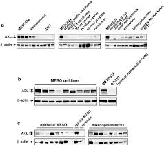 Mesothelioma is an especially rare and aggressive type of cancer, caused almost exclusively by exposure to asbestos. A Immunoblotting Demonstrates Strong Axl Expression In Mesothelioma Download Scientific Diagram