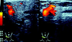 Image result for Lemon 1986 Radiation Group