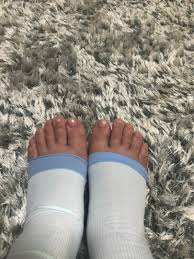 妊娠37週 臨月のむくみが酷い | ☆2018年7月12日出産☆ママ社長日記