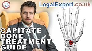 Image result for Capitate Bone