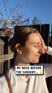 Proof that a little tweak can make a big difference 👃✨🤩