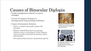 Image result for Diplopia