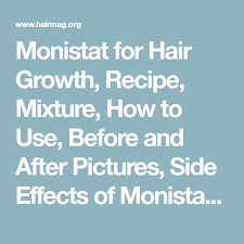 Potential side effects of using monistat for hair regrowth so what might happen if you do decide to use monistat for your hair? Monistat For Hair Growth Recipe Mixture How To Use Before And After Pictures Side Effects Of Monistat 7 On H Hair Growth Foods Hair Growth Hair Growth Diy