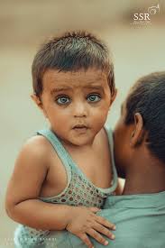 Biology The near point of a normal eye is A. 250cm B. 0.0025m C. 250mm D.  2.50cm E. None