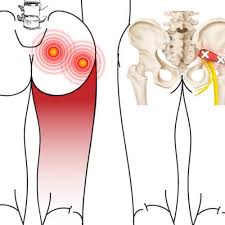 Pin On Posture Exercises