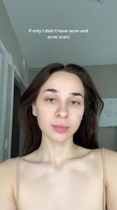 Embracing Natural Beauty: Elsa Without Makeup