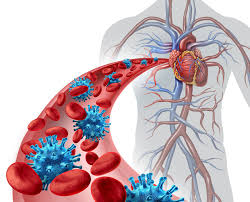 Maybe you would like to learn more about one of these? Sepsis La Enfermedad Silenciosa Mas Letal