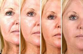 Can you get rid of smile and laugh lines? How To Get Rid Of Laugh Lines Give You A Good Advice About Best Blenders