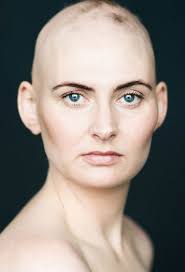 Four women talk about alopecia, and international alopecia day®. Bald Is Beautiful Stunning Images Of Women With Alopecia Challenge Traditional Notions Of Femininity World News Mirror Online