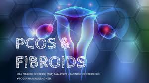 Studies have not found a link between pcos and breast cancer formally. Fibroids Vs Pcos Blog Article Usa Fibroid Centers