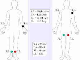 12 Lead Ecg Lead Placement Diagrams Ems 12 Lead