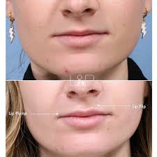 Mandi Lonergan FNP-C (@mandi_forthefacebayarea) · Palo Alto, CA