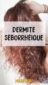 Soigner Naturellement La Dermite Seborrheique En 2020 Sante Des Cheveux Dermite Seborrheique Cuir Chevelu Qui Gratte