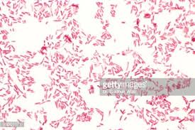They are characterized by their cell envelopes, which are composed of a thin peptidoglycan cell wall sandwiched between an inner cytoplasmic cell membrane and a bacterial outer membrane. Pin En Escherichia Coli Gram Stain