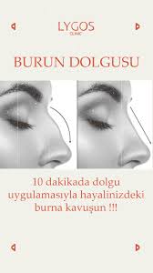 Burun Dolgusu Estetik Bilgi Iletisim