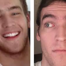 Fundraiser by Michael Turk : Help My Brother See Again