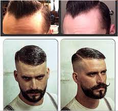 Men with visible, patchy hair loss. Strong Hair Styling Cream For Men Buy Strong Hair Styling Cream Hair Straightening Cream Strong Hair Styling Cream Product On Alibaba Com