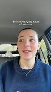 Need Help with Hair Fail