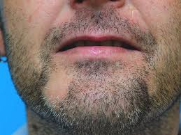 Clean your face any time it gets dirty, sweaty or oily during the day. Why Can T I Grow A Beard 5 Reasons Plus Beard Growth Strategies