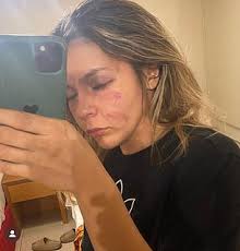 Imane Khelif left rival thanking GOD for escaping horrific injuries in 2022  fight