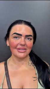 The lovely Leah from Essex, what can we say, you asked and we delivered.  Leah wanted a brand new white Hollywood smile. She left our clinic glowing.  We completed her smile in just 3 days. Thank you ...