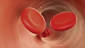 Image result for Cardiovascular Syphilis