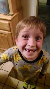 Jack-o'-lantern just got braces