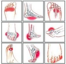 Pin On Health Recipe