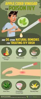 Apple Cider Vinegar For Poison Ivy Easy And Simple Way To Treat Ivy Rash Poison Ivy Remedies Remedies Infographic Home Remedies For Warts