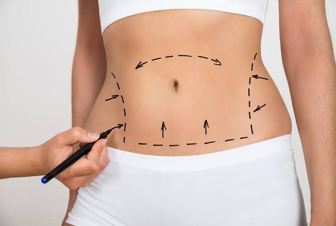 7 Tips for Choosing the Best Tummy Tuck Surgeon in Dubai