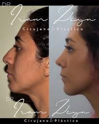 Sin saberlo, el hombre compone su vida de acuerdo a las leyes de la  belleza, aún en momentos de mas profunda desesperación.