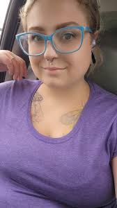 Dog bite injury and recovery experience