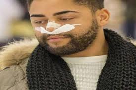 Big Brother star Mark Byron the victim of an alleged homophonic attack in  Liverpool