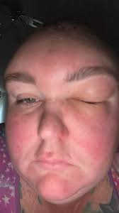 Surviving a Medical Operation: A Personal Journey