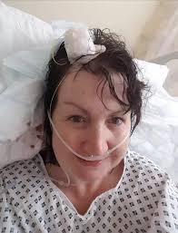 Mum with rare brain condition was left feeling like her 'head was being  ripped off'