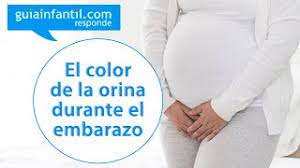 Los Cambios En El Color De La Orina De La Mujer Embarazada Guiainfantil Responde Youtube