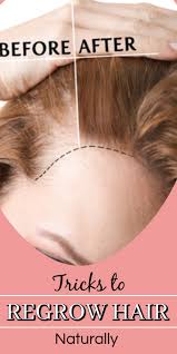 Natural Hair Regrowth Is Possible With These 5 Miraculous Home Remedies Haircaretips Hairgrowthtreatm Natural Hair Regrowth Regrow Hair Naturally Regrow Hair