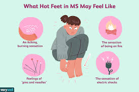 On top of worries about medication, blood sugar regulation if you do notice an ulcer, stay off the affected foot and talk to your doctor. Hot Feet In Ms Symptoms Causes Diagnosis And Treatment