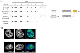 What is the recommended age to do mammogram? Jmc Medical Kk