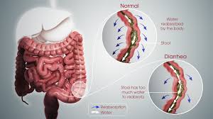 Diarrhea Pathophysiology Treatment And Management