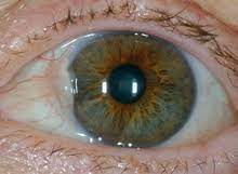 Juckreiz im auge oder rötung des augapfels, besonders nahe der hornhaut, pupille und iris wenn das pterygium eine bestimmte größe erreicht, verändert es die oberflächenstruktur des auges, was. Pterygium Conjunctivae Wikipedia