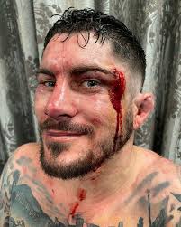 Now that looks like a guy who's been in a fight! @ryan_thelion_lilley  fought a great fight last night, didn't get the W but it was FOTN. Great  opponent, we all had a
