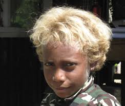 In the world, blond hair is exceptionally rare outside europe. Naturally Blond Hair In Solomon Islanders Rooted In Native Gene Study Finds News Center Stanford Medicine