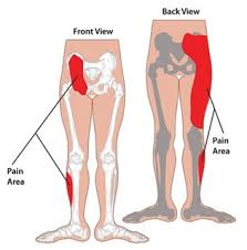 Clinically proven natural pill for joint pain relief in 2 weeks. Si Joint Sprain Pain Dysfunction Perth Sports Chiropractor Inglewood Mount Lawley Wa Formerly In Bassendean