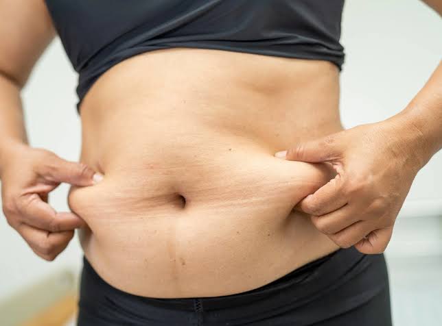 Transform Your Curves With Abdominoplasty Or Tummy Tuck Surgery - Perfect  Doctors Clinic