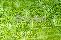 Maybe you would like to learn more about one of these? Microscopic Plant Cells Images Kuhn Photo