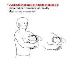 Image result for Rapid Alternating Movements